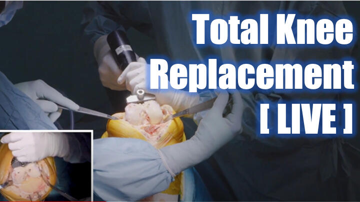 LIVE surgery: total knee replacement