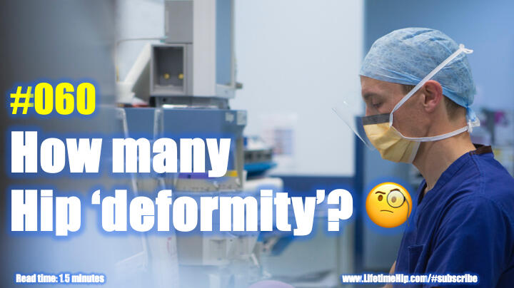 How many Hip ‘deformity’? 🧐