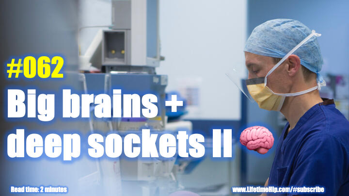 Big brains + deep sockets II