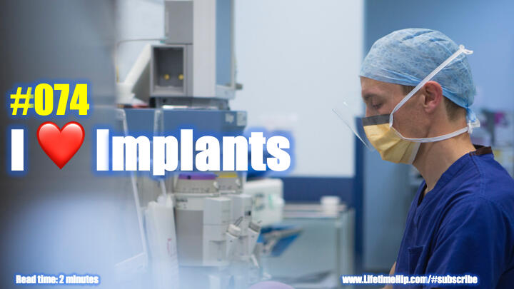 I love implants